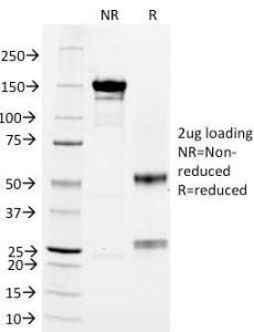 Anti-CD3 epsilon antibody