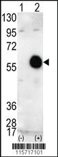 Anti-AKT2 Rabbit Polyclonal Antibody