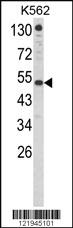 Anti-IFNAR1 Rabbit Polyclonal Antibody