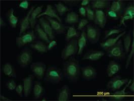 Anti-FH Mouse Monoclonal Antibody [clone: 5C12]