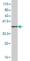 Anti-RASGRP2 Mouse Monoclonal Antibody [clone: 3D8]