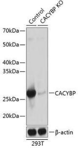 Western blot analysis of extracts from normal (control) and CACYBP knockout (KO) 293T cells, using Anti-CacyBP Antibody (A307007) at 1:1000 dilution. The secondary Antibody was Goat Anti-Rabbit IgG H&L Antibody (HRP) at 1:10000 dilution