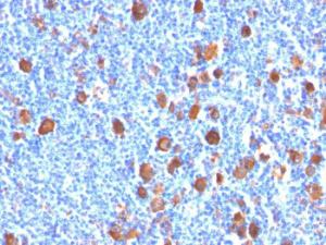 Anti-Fascin Mouse Monoclonal Antibody [clone: FSCN1/416]