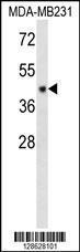 Anti-CF150 Rabbit Polyclonal Antibody (APC (Allophycocyanin))