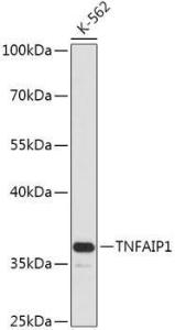 Anti-TNFAIP1 Rabbit Polyclonal Antibody