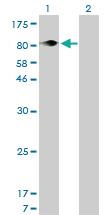 Anti-ITGB5 Mouse Monoclonal Antibody [clone: 2C4]