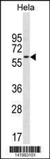 Anti-CD3EAP Rabbit Polyclonal Antibody (Biotin)