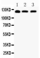 Anti-SIRT1/Sirtuin 1 Polyclonal Antibody