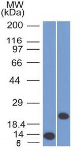 Anti-CD3 epsilon antibody