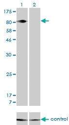 Anti-ITGB5 Mouse Monoclonal Antibody [clone: 2C4]