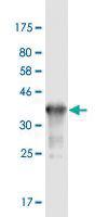 Anti-RAB3B Mouse Monoclonal Antibody [clone: 1A7]