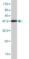 Anti-TGOLN2 Mouse Monoclonal Antibody [clone: 2F11]