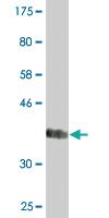 Anti-SPP1 Mouse Monoclonal Antibody [clone: 3G6]