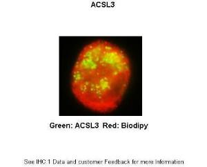 Anti-ACSL3 Rabbit Polyclonal Antibody