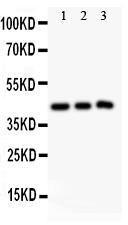 Anti-SIRT2/Sirtuin 2 Polyclonal Antibody