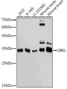 Anti-CBR1 antibody