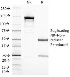 Anti-CD3 epsilon antibody