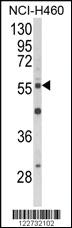 Anti-AKT2 Rabbit Polyclonal Antibody