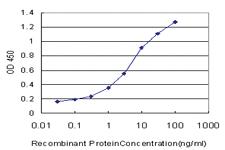 Anti-FH Mouse Monoclonal Antibody [clone: 5C12]