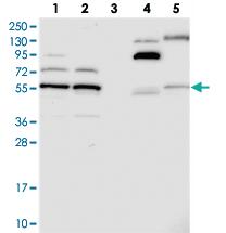 Anti-C5ORF22 Rabbit Polyclonal Antibody