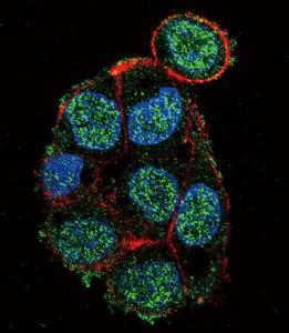 Anti-VHL Rabbit Polyclonal Antibody (AP (Alkaline Phosphatase))