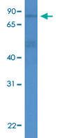 Anti-ADD3 Rabbit Polyclonal Antibody