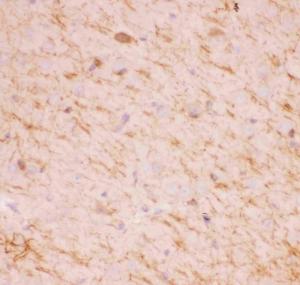 Anti-SIRT2/Sirtuin 2 Polyclonal Antibody