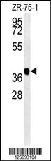 Anti-NIPAL2 Rabbit Polyclonal Antibody