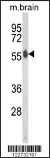 Anti-AKT2 Rabbit Polyclonal Antibody