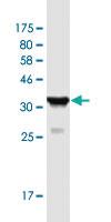 Anti-PDCD10 Mouse Monoclonal Antibody [clone: 1B11]