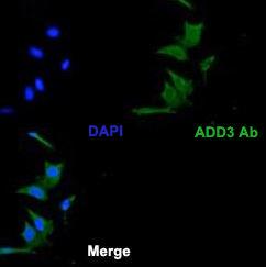 Anti-ADD3 Rabbit Polyclonal Antibody