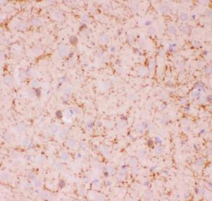 Anti-SIRT2/Sirtuin 2 Polyclonal Antibody