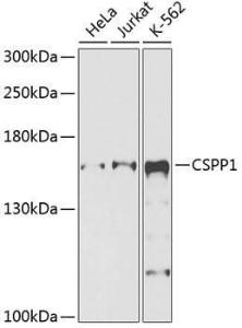 Anti-CSPP1 Rabbit Polyclonal Antibody