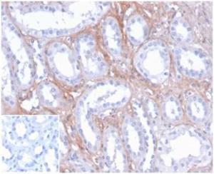 Anti-FGF23 antibody