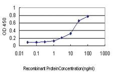 Anti-ITGB5 Mouse Monoclonal Antibody [clone: 2C4]