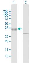 Anti-SPRY2 Rabbit Polyclonal Antibody