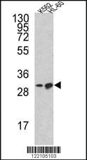 Anti-BCL2L11 Rabbit Polyclonal Antibody