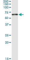 Anti-MAOB Polyclonal Antibody Pair