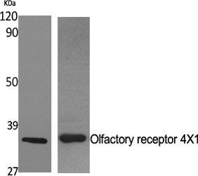 Anti-OR4X1 Rabbit Polyclonal Antibody