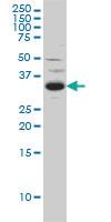 Anti-SPRY2 Mouse Monoclonal Antibody [clone: 1E10]