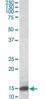 Anti-LGALS1 Goat Polyclonal Antibody