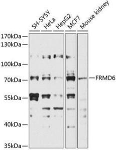 Western blot analysis of extracts of various cell lines, using Anti-FRMD6/Willin Antibody (A12445) at 1:1,000 dilution The secondary antibody was Goat Anti-Rabbit IgG H&L Antibody (HRP) at 1:10,000 dilution Lysates/proteins were present at 25 µg per lane