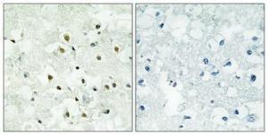 Immunohistochemical analysis of paraffin-embedded human brain using Anti-PMS2 Antibody 1:100 (4°C overnight). The right hand panel represents a negative control, where the antibody was pre-incubated with the immunising peptide.