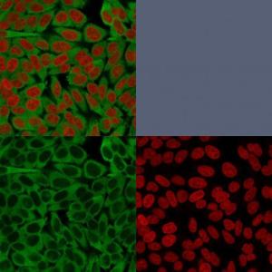 Anti-Fascin Mouse Monoclonal Antibody [clone: FSCN1/416]