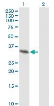 Anti-SPRY2 Mouse Monoclonal Antibody [clone: 1E10]