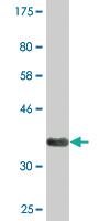 Anti-SPP1 Mouse Monoclonal Antibody [clone: 4D8]