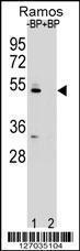 Anti-ZDHHC2 Rabbit Polyclonal Antibody (AP (Alkaline Phosphatase))