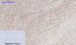 Anti-MMP2 Rabbit Polyclonal Antibody