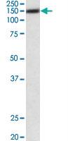 Anti-ATP2B1 Goat Polyclonal Antibody