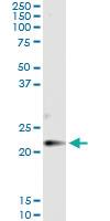 Anti-CLDN14 Antibody Pair